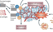 「肿瘤光动力治疗（PDT）」介绍及纳米材料的潜在应用