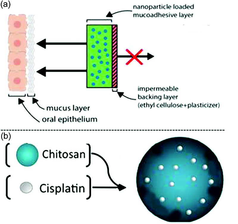 Nature Communications：  纳米工程化顺铂递送系统治疗口腔癌的临床研究